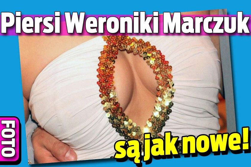 Piersi Weroniki Marczuk są jak nowe! FOTO