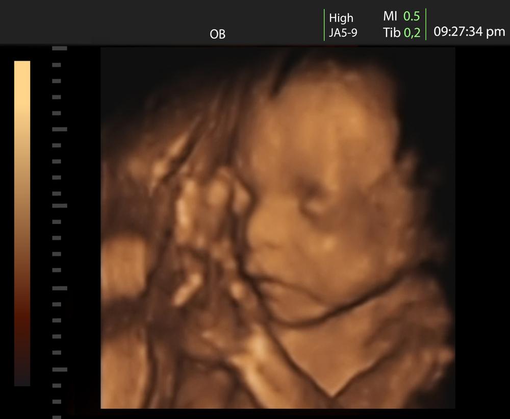 23. týždeň tehotenstva: A tak sme napokon odhalili pohlavie nášho bábätka -  Tehotenstvo: príbeh z pohľadu ženy | Najmama.sk