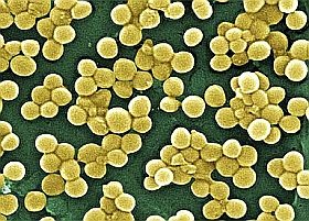 mrsa-bakterium-d000012448ebbfb4acbb5