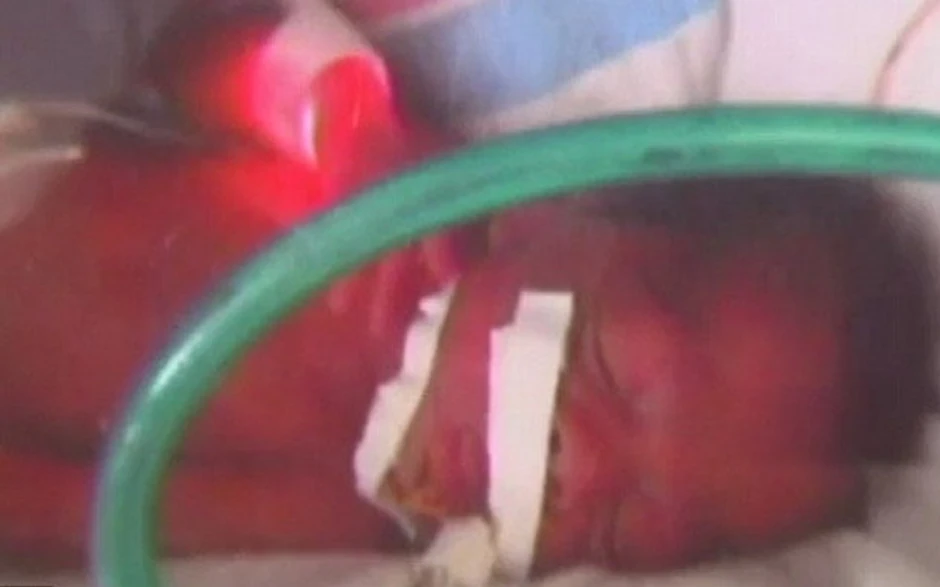 Carskim rezom je donela na svet potpuno zdrave blizance - Nikolasa i Aleksandra