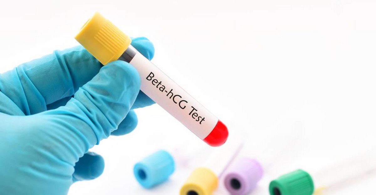 Test ciążowy z krwi - terminy, wiarygodność i cena