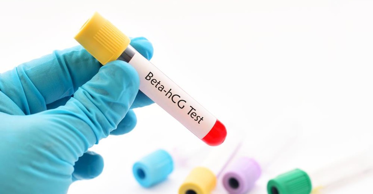 Test ciążowy z krwi terminy, wiarygodność i cena