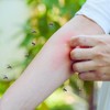 Miris tela je presudan faktor koji određuje koga će komarac ujesti