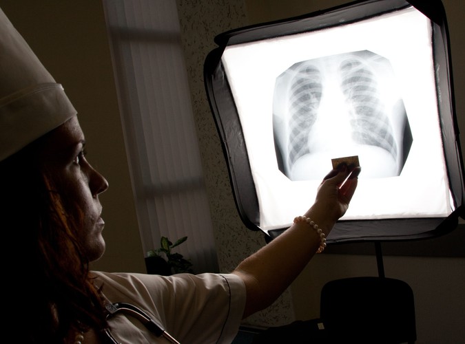 Gruźlica nadal groźna