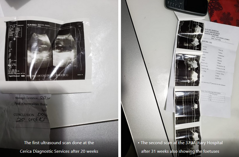 Pregnancy scan results