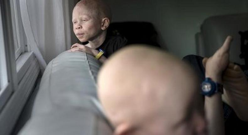 Tanzania criticises film documenting attacks on albinos for witchcraft