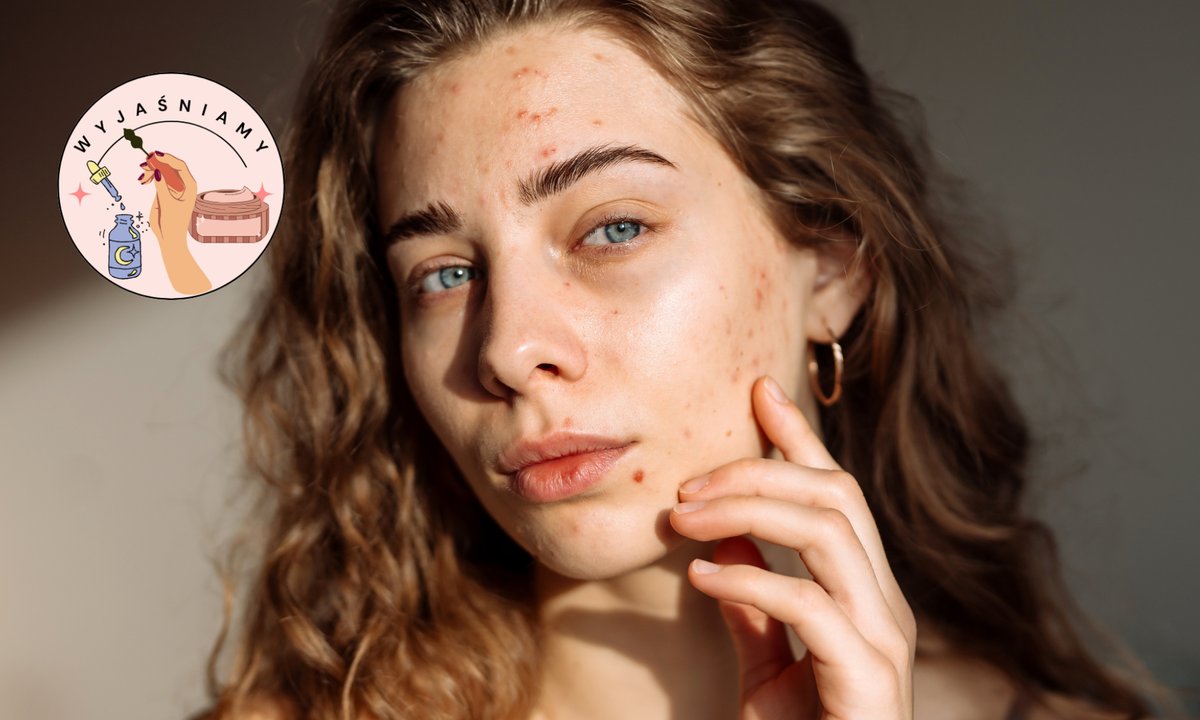 Makijaż, który powoduje wypryski i zapycha skórę? Te błędy popełniamy bardzo często