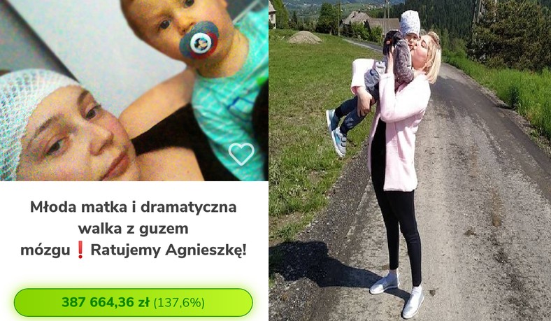 Kwota, którą zebrała Agnieszka na leczenie, m.in. dzięki użytkownikom Onetu