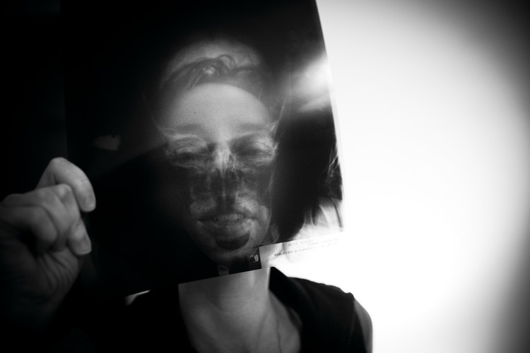 I nagroda w kategorii ŻYCIE CODZIENNE fotoreportaże Piotr Grzybowski, „Super Express”. <br /><br />Warszawa, Jabłonna. Vanessa, matka dwóch niepełnosprawnych chłopców cierpiących na chorobę genetyczną, walczy o ich zdrowie i godziwe życie.