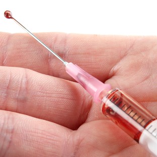 HIV-szűrés: a 20 perces gyorsteszt életet ment