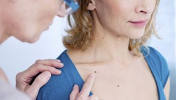 Co robić, aby latem nie nabawić się przebarwień