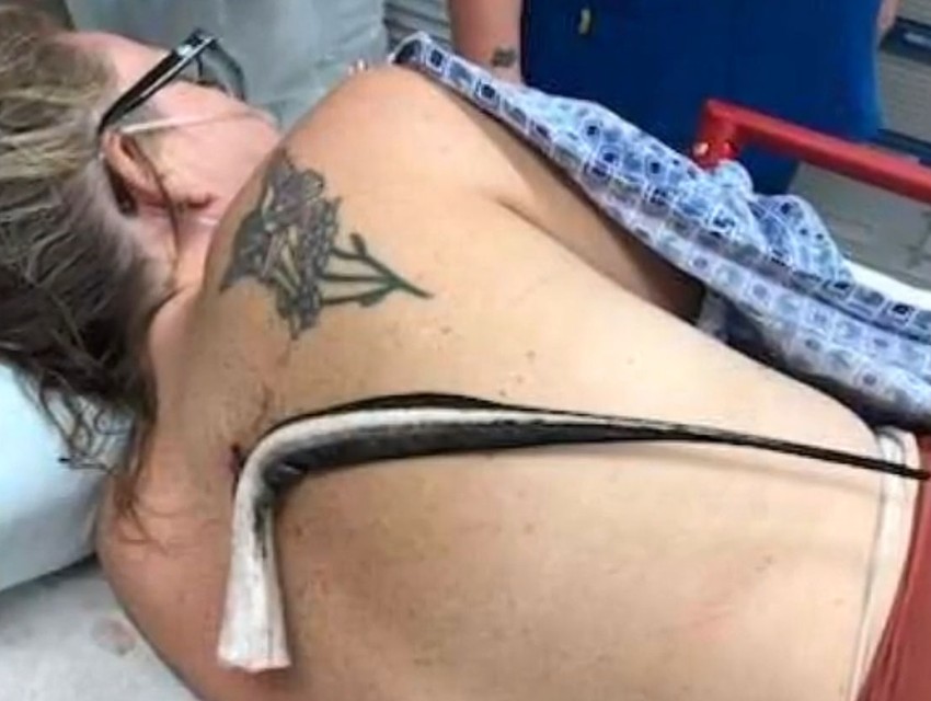 Ženu na Floridi ubola otrovna raža