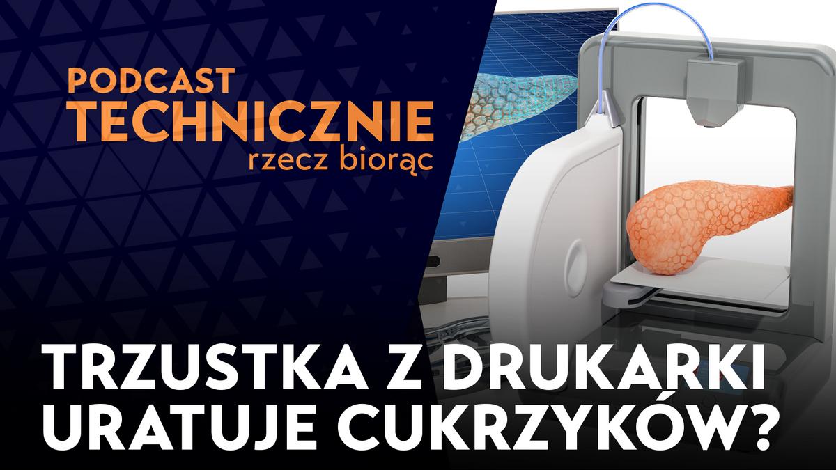 Bioniczna Trzustka Z Drukarki 3d Polacy Chcą Wyleczyć Cukrzycę Typu I 5260