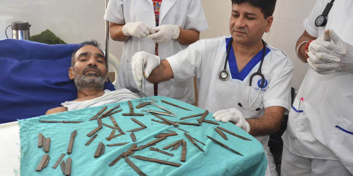 Indie. Chirurg Jatinder Malhorta wydobył 40 noży z brzucha pacjenta