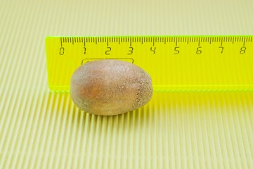 Az epeköveket nagyrészt koleszterin alkotja és gyakran sárga színűek. A kövekben leginkább feloldatlan koleszterin található, de más anyag is lehet benne.