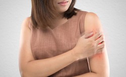 "Jakość życia pacjentów z AZS jest mocno obniżona". Jak im pomóc?