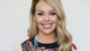 Katie Piper bez makijażu. Nie boi się pokazywać blizn po oparzeniu