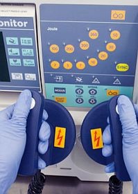 defibrillator-keringes-sziv-d00000E2473382b0d9d2a