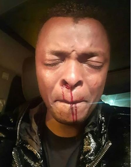 Weezdom Claims Ringtone Apoko Was Beaten After Gate Crashing A