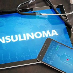 Mi az inzulinóma? Tünetek, diagnózis és gyógyulási esélyek