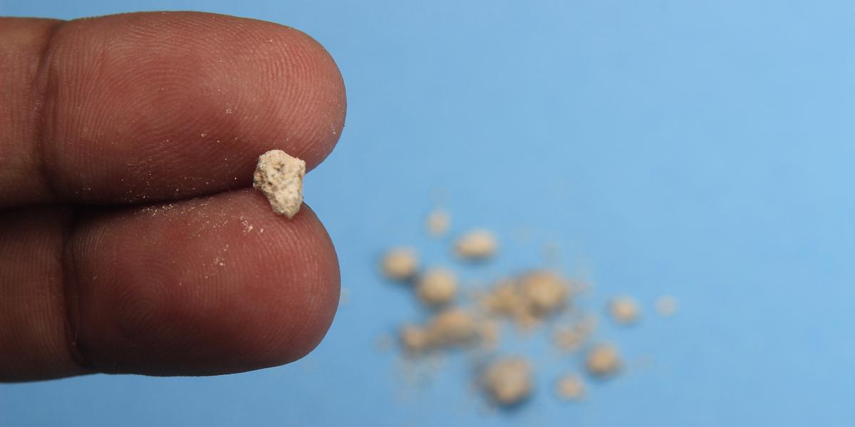 What are Kidney Stones?