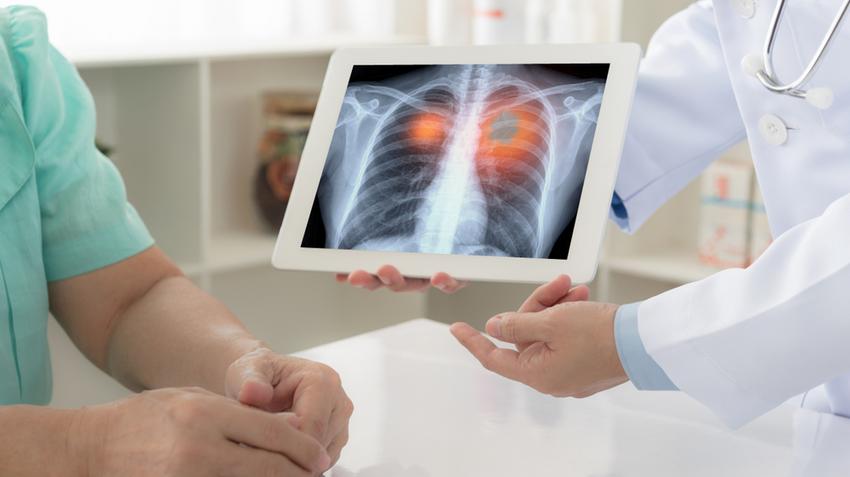 tüdőrák gyanú kivizsgálás gyógyulás betegút