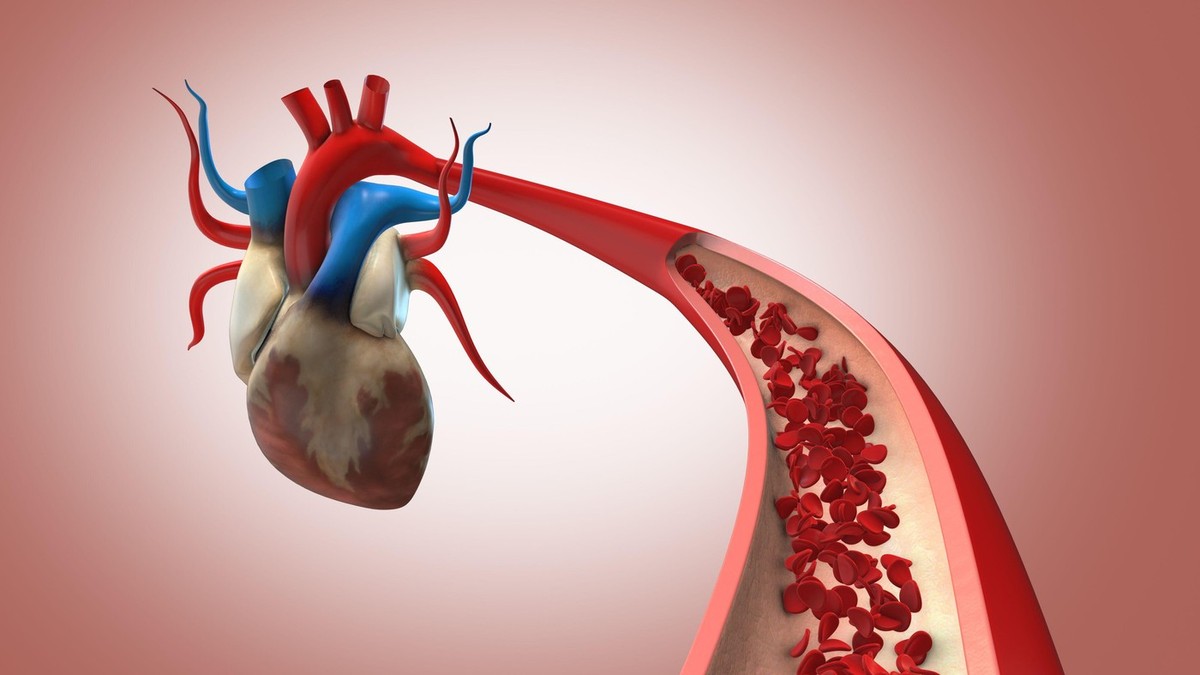 Vrednosti lipoproteina (a) su stabilne, pa jedan uzorak krvi daje doživotni odgovor na pitanje da li osoba nosi ovaj genetski rizik