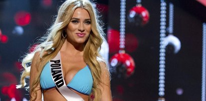 Miss Polonia myśli o operacjach. Potrzebuje ich?