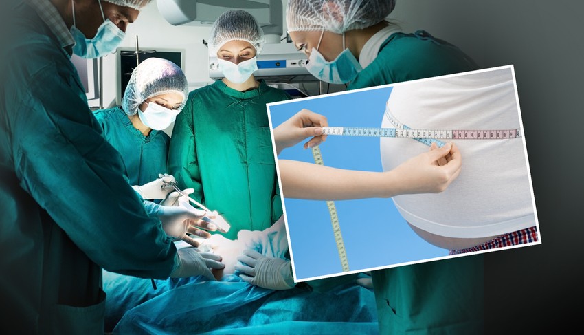 O trošku države omogućeno je i hirurško lečenje gojaznosti