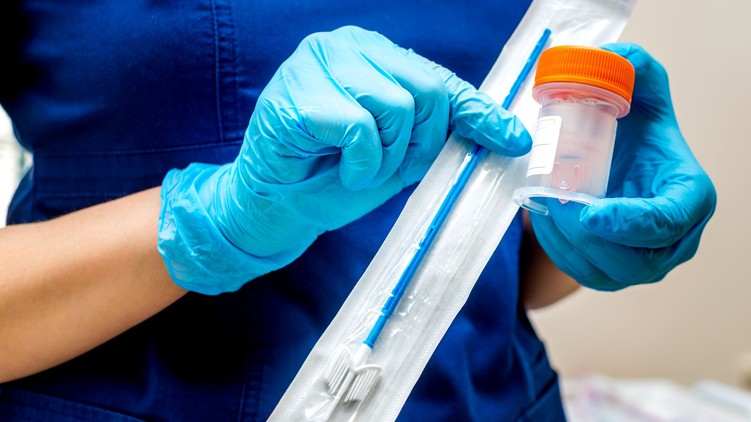 citológia, méhnyakrák, hpv, teszt, vizsgálat, szűrés