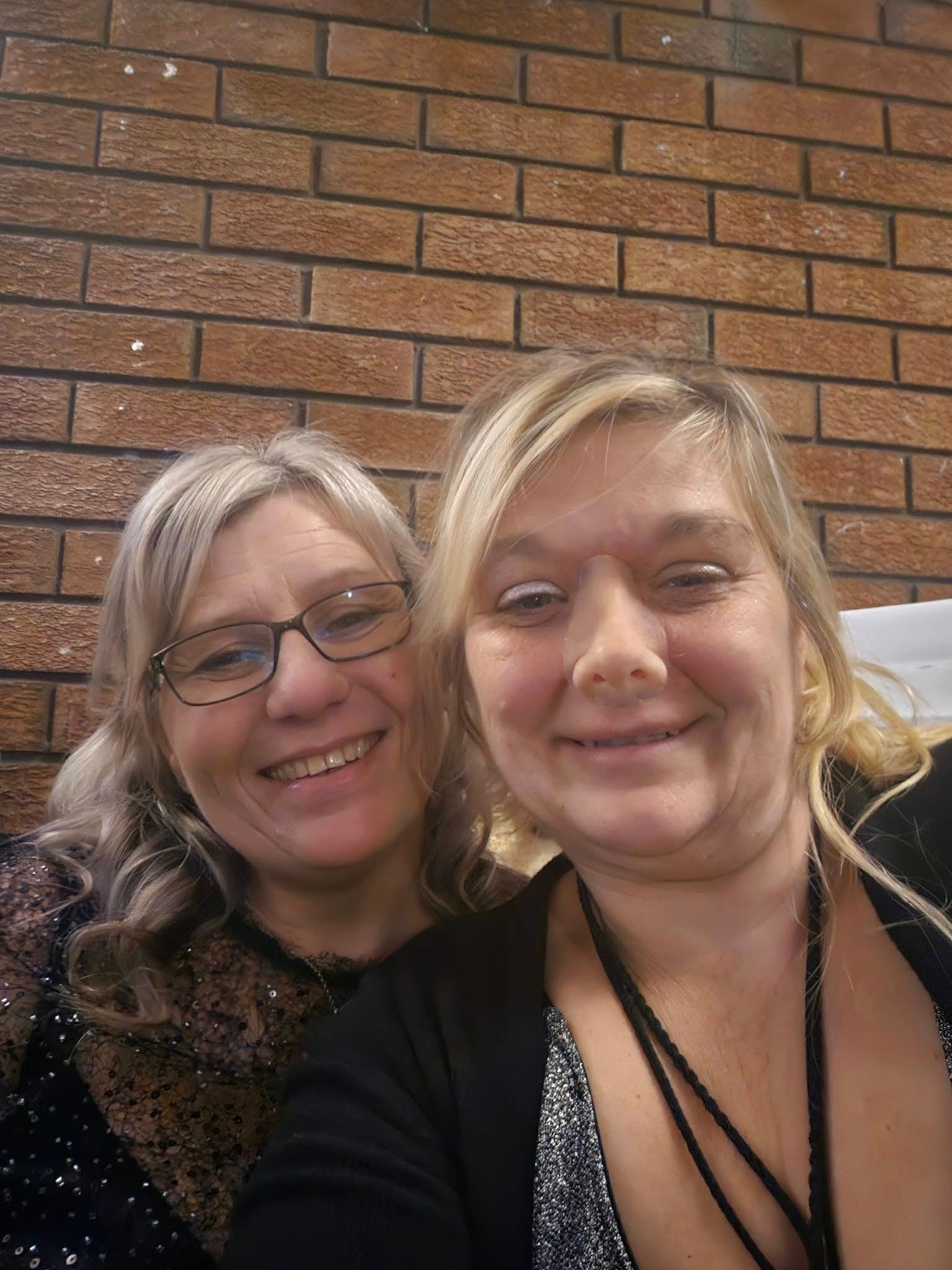 Ellen teraz nosí umelý nos.