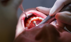 Jak rozpoznać złego dentystę. Lekarze podpowiadają, co powinno nas zaniepokoić