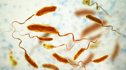 Cholera (choroba) - przyczyny, objawy, leczenie i profilaktyka. Co wiemy o epidemiach cholery?