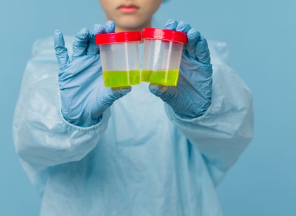 Ezek a vitaminok megváltoztatják a vizelet színét - ne aggódjon miatta! című cikk nyitóképe