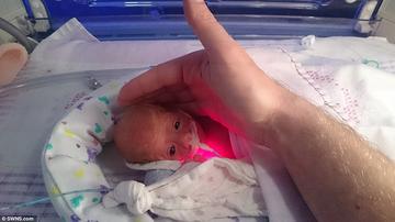 55 dekásan, a 28. hétre született a baba, esélye sem volt a túlélésre. A  tescós tasak megmentette az életét (fotó) - Blikk Rúzs