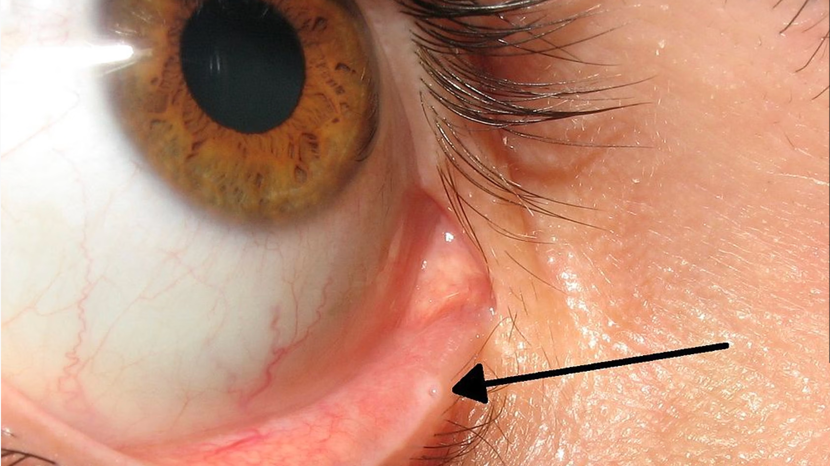 Všimli ste si niekedy malú dierku v kútiku oka?