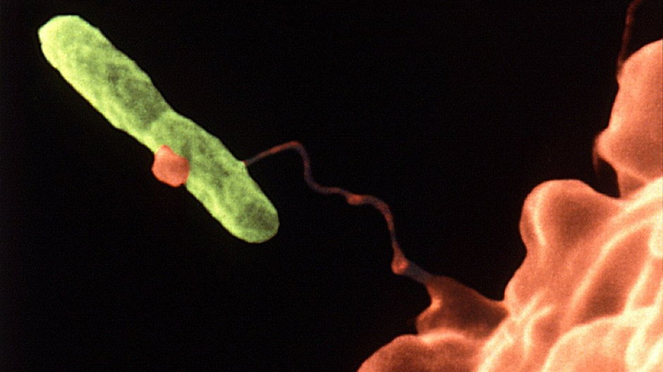 Bakteria legionelli przechwycona przez amebę