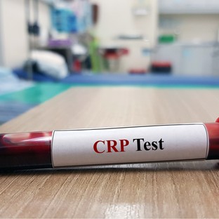 Mit jelent a CRP érték a laborleleten?