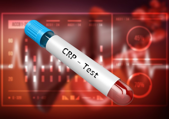 Rejtett gyulladás a szervezetben: ezek a túl magas CRP-szint tünetei