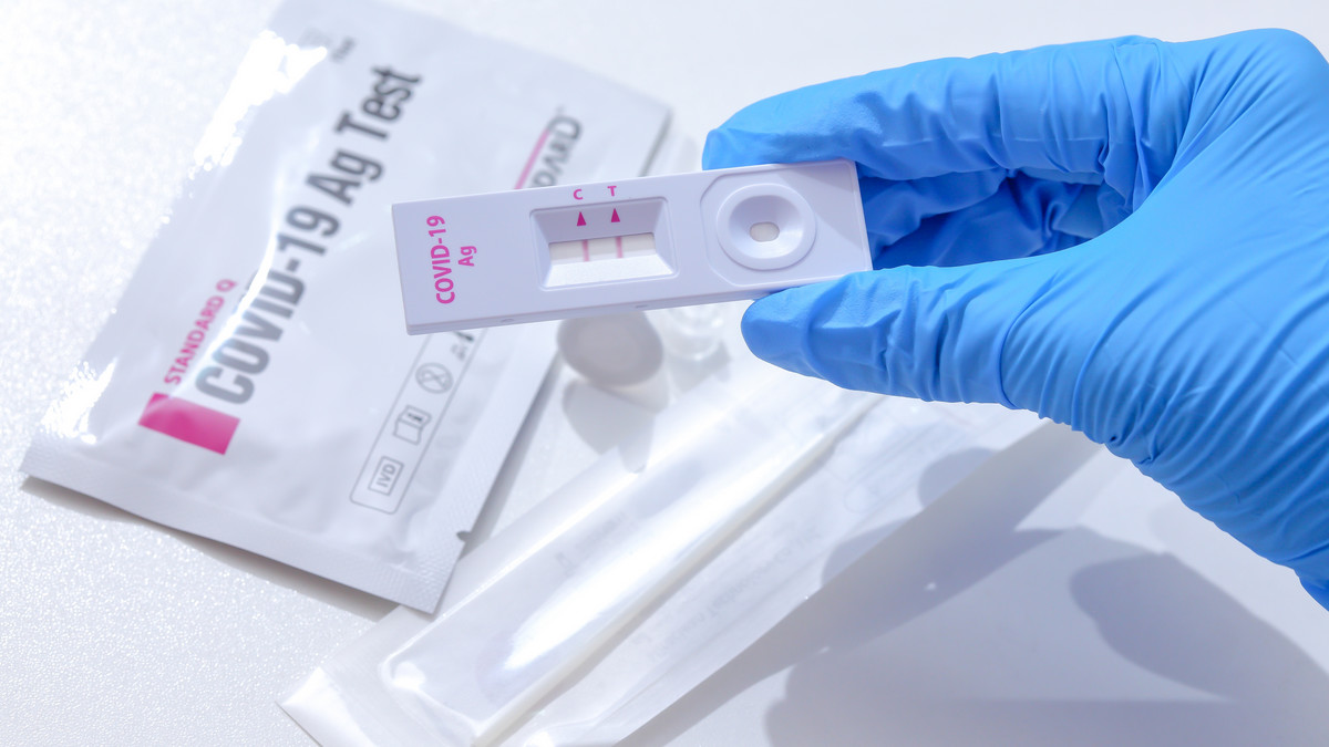 Test antygenowy – instrukcja obsługi. Nie rób tych błędów!