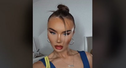 21-latka pojechała do Turcji na operację plastyczną nosa. Jej efektem pochwaliła się w sieci. To hit internetu [FILM]