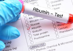 Albumin je protein u krvnoj plazmi