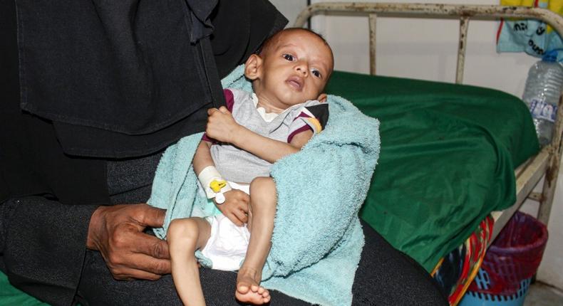 A malnourished child receiving treatment at a hospital in Yemen: a UN report said more than 821 million people worldwide suffered from hunger in 2018