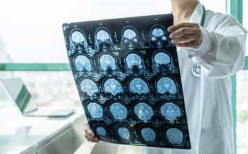 Minél tovább élünk, annál nagyobb kihívást jelent világszerte ez a probléma