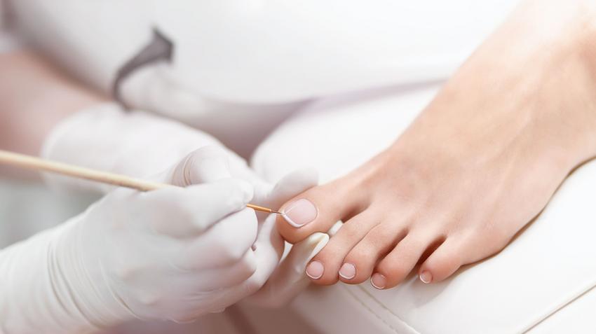 a kezelés gomba körmök lábak lakkok medicine tablettákat nail gombák