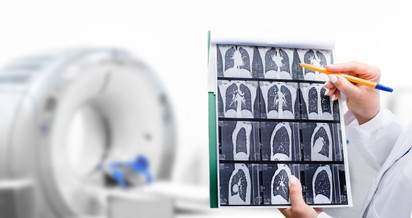 Nőnap alkalmából tüdőrákszűrő napot hirdet az Országos Korányi Pulmonológiai Intézet