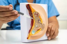 Dieta bogata w tłuszcz może sprzyjać rozwojowi raka piersi