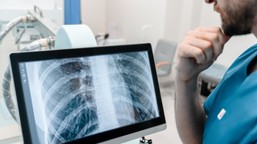 gruźlica w krakowskim liceum. ponad 100 osób znalazło się pod nadzorem epidemiologicznym