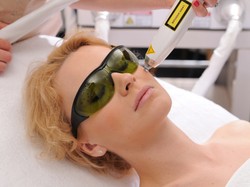 Młody wygląd bez skalpela? Potraktuj się laserem!