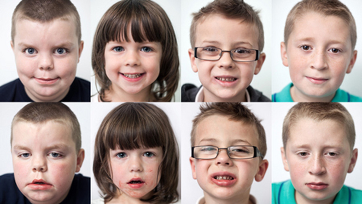 Fotograf Andy Brown poprosił pacjentów Szpitala Pediatrycznego w Sheffield o pozowanie do zdjęć przed operacją dentystyczną i po usunięciu zębów. Uzyskał pary portretów ukazujące, jak wyczerpującym przeżyciem jest dla maluchów taki zabieg.
